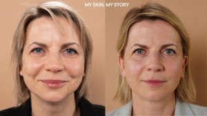 BABOR_MY SKIN, MY STORY: Почему кожа становится тусклой и как вернуть ей сияние