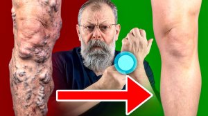 5 ПРИЁМОВ, КОТОРЫЕ ОБЛЕГЧАТ БОЛЬ В НОГАХ И СУСТАВАХ