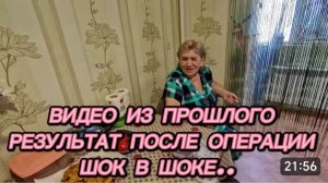 САМВЕЛ АДАМЯН, ПО ПРОСЬБАМ ЗРИТЕЛЕЙ, РЕЗУЛЬТАТ ПОСЛЕ ОПЕРАЦИИ, ШОК, ДО И ПОСЛЕ..