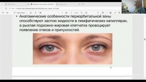 Самомассаж лица с Ириной Никифоровой 10.3 18:00