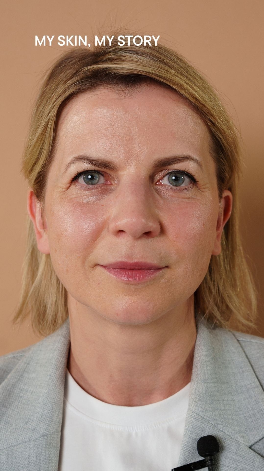 BABOR_MY SKIN, MY STORY: кожа стала более плотной и свежей — результат комплексного ухода