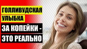 ВИНИРЫ НА ЗУБЫ КУПИТЬ В АПТЕКЕ ⭐ ЦЕНА ВИНИРЫ В САНКТ ПЕТЕРБУРГЕ