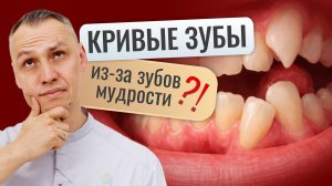 СКУЧЕННОСТЬ ЗУБОВ ИЗ-ЗА 8-ОК?