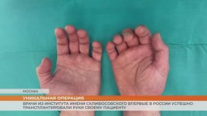 Врачи из института имени Склифосовского впервые в России успешно трансплантировали руки пациенту
