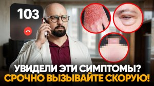 ЭТИ СИМПТОМЫ ОПАСНЫ ДЛЯ ЖИЗНИ! СРОЧНО ВЫЗЫВАЙТЕ СКОРУЮ!