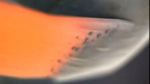 Пяточная шпора