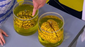 В "Жить здорово!" раскрыли, какое давление ведет к инсульту, а какое - к слабоумию