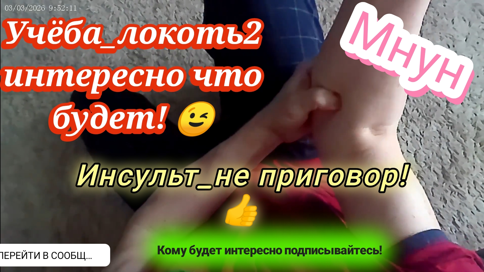 Инсульт_интересно что будет_локоть2