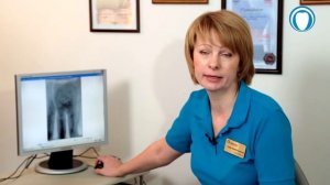 Успешное удаление отломков инструментов из каналов зубов с помощью