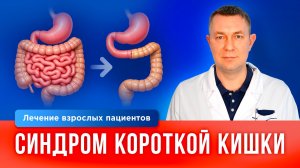 Синдром короткой кишки: почему не усваиваются витамины и как лечить патологию бесплатно по ОМС?