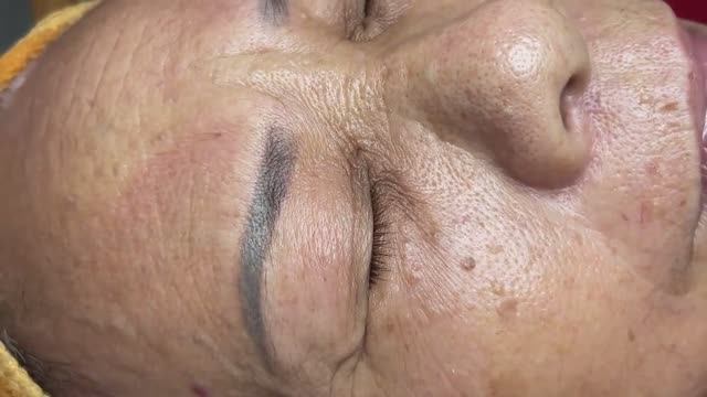 Профессионально чистим кожу от угрей Hari # 009