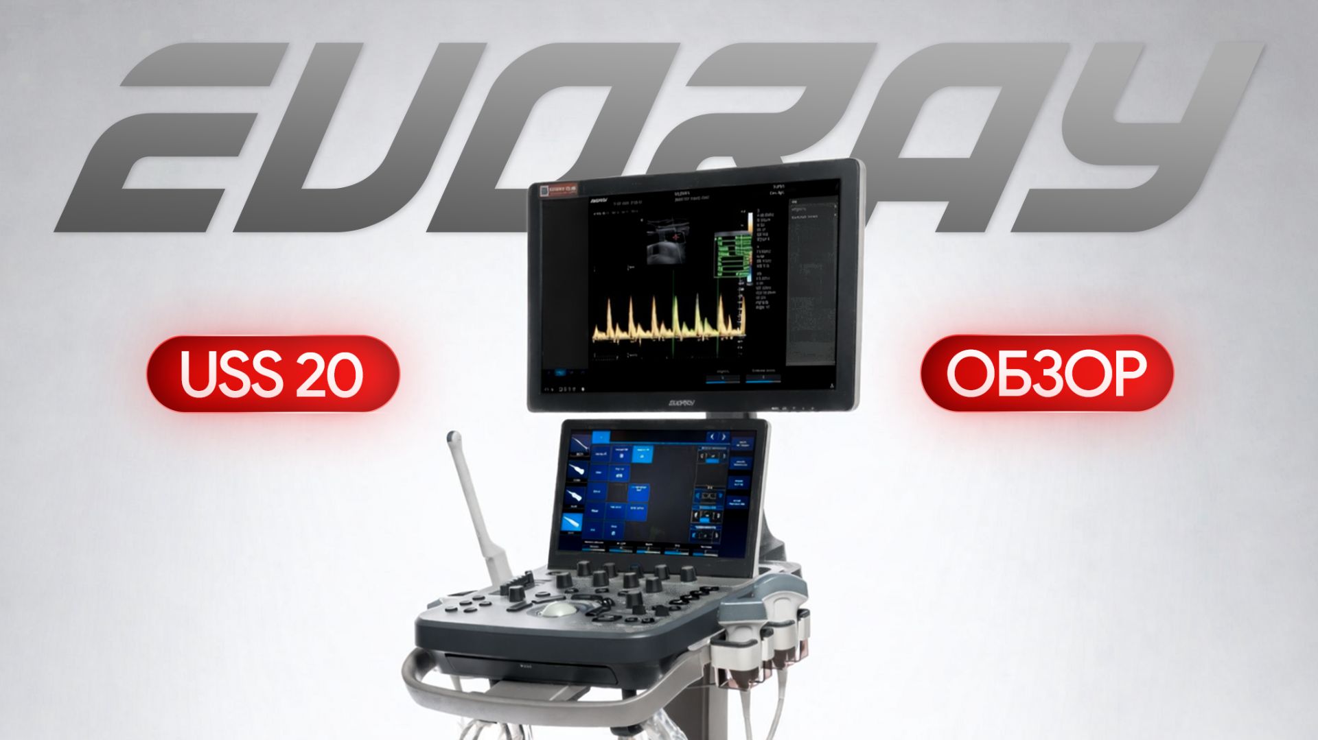 Обзор УЗИ аппарата EVORAY USS 20: что показывает в реальной диагностике?