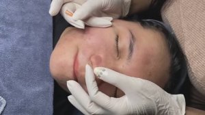 Удаляем глубокие черные точки MiMi