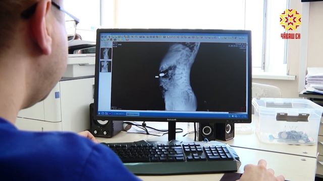 В 2026 году в Чувашии более 40 детей обратились с проблемой попадания в организм инородных предметов