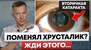 Это ждёт КАЖДОГО после замены хрусталика - вторичная катаракта
