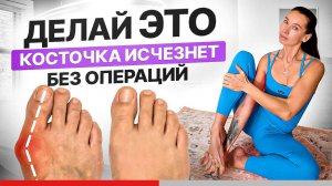 Косточка на ноге растёт из-за ЭТОГО… ТОП упражнений от шишки на стопе