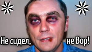 «ЛЬВОВСКОГО РАСКОРОНОВАТЬ 👑» ПЕЧАЛЬНАЯ СУДЬБА СМОТРЯШЕГО ЗА КИЕВОМ