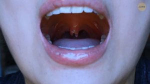 Почему у людей почти не бывает фиолетовых глаз? И ещё факты о теле, которые вас удивят ️