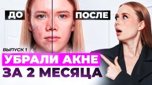Чистая кожа за 60 дней! Преображение В ДОМАШНИХ УСЛОВИЯХ: пошаговый план