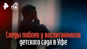 Следы побоев обнаружили сразу у нескольких воспитанников детского сада в Уфе