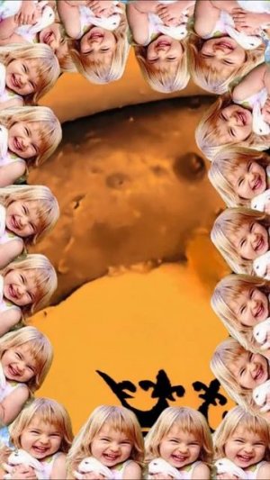 Чистка лица от угрей и акне. Выдавливание прыщей. Удаление черных точек и комедонов