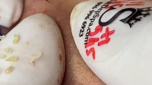 001 • Relax Spa • АСМР • Acne collection