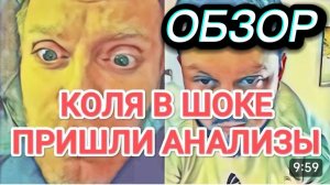 САМВЕЛ АДАМЯН, ОБЗОР ОТ ОЛЬГИ, ПРИШЛИ АНАЛИЗЫ КОЛИ, САМВЕЛ ЗАПЛЕВАЛ ВЕСЬ ТИКТОК