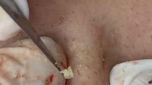 006 • Relax Spa • АСМР • Acne collection