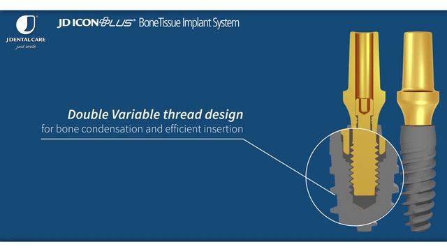 Линейка имплантатов JDental Icon Plus