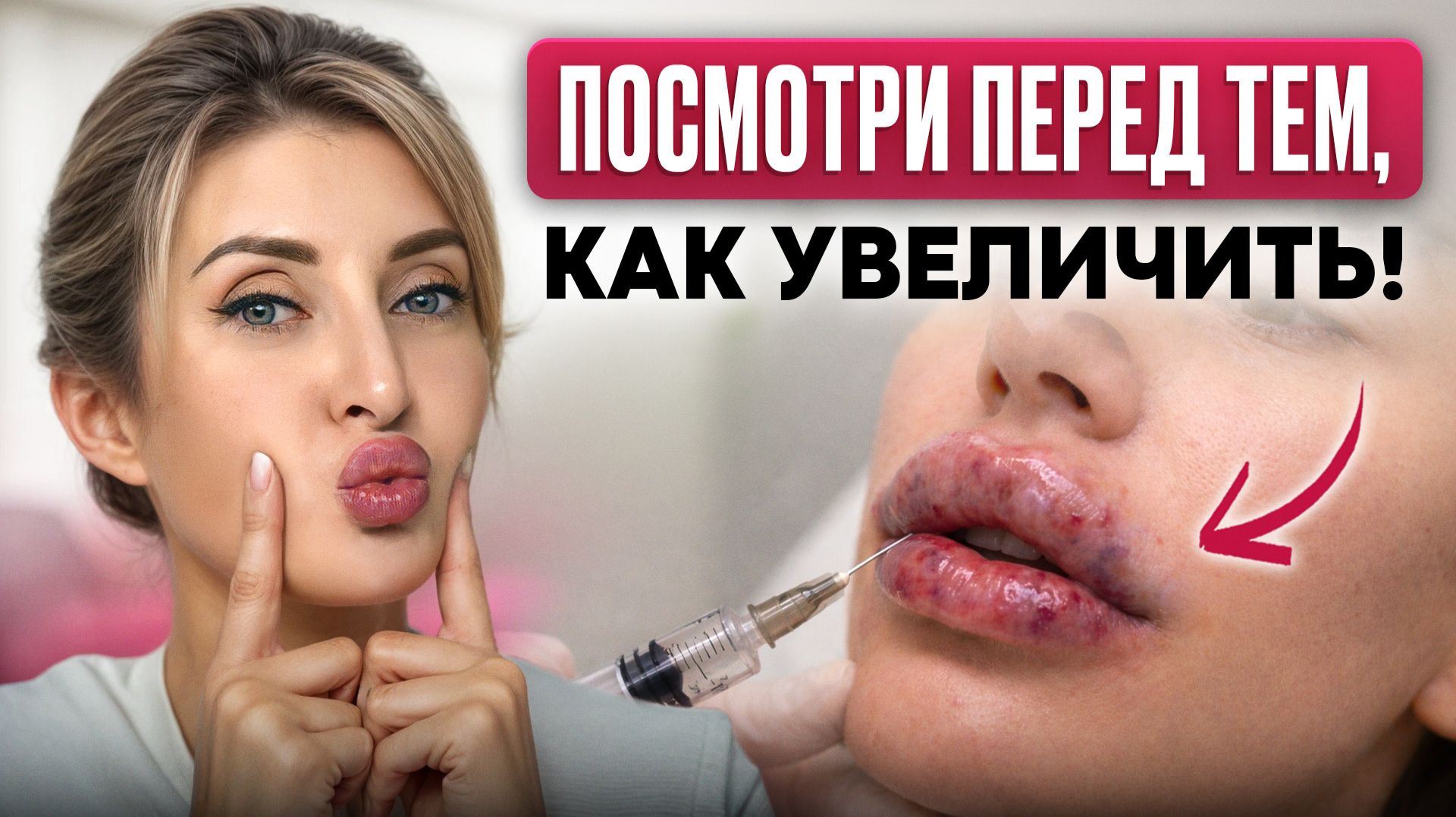 НЕ КАЧАЙТЕ губы, пока не увидите ЭТО! Как понять, пойдут ли вам ПУХЛЫЕ губы? Лайфхак от косметолога