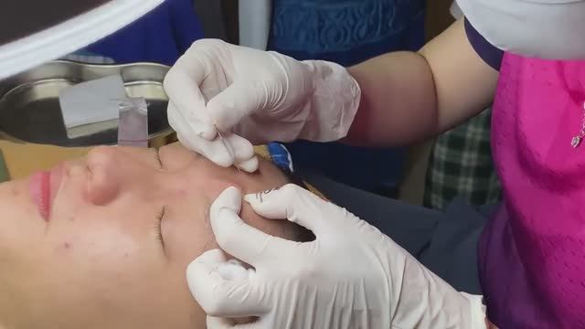 Лечение подкожных прыщей: выводим глубокие воспаления - SDS#196