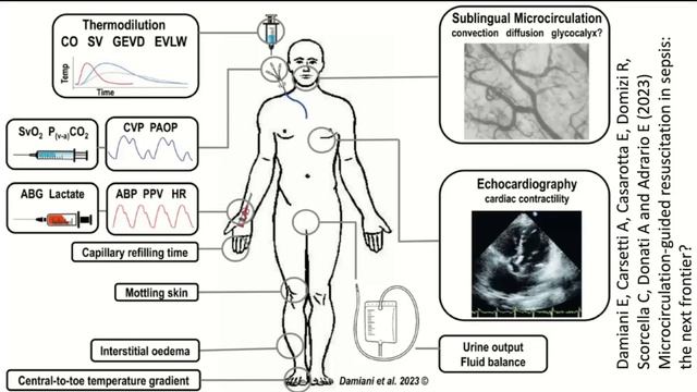 Ишемия-реперфузия в критич состоян Симутис И.С. 2026