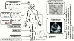 Ишемия-реперфузия в критич состоян Симутис И.С. 2026
