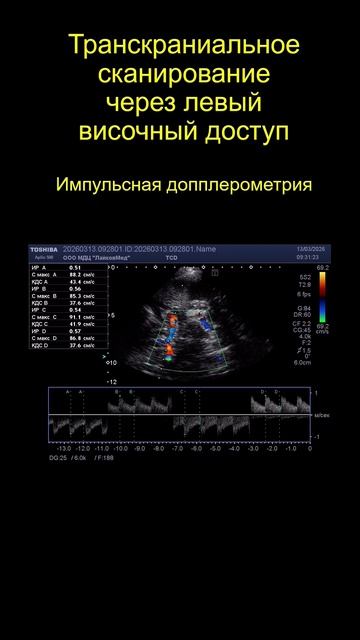 УЗИ. Транстемпоральное сканирование.