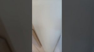 я хоть и лежу в больнице но я все ровно для вас снимаю😘