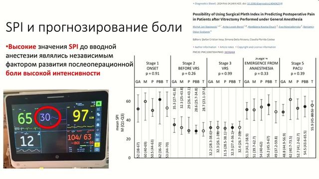 Персонализация анальгезии Сыроватский А.А. 2026