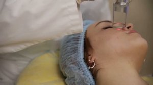 Фракционный фототермолиз. Лечение акне в Москве. Как избавиться от постакне. Лечение угревой сыпи.