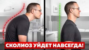 ЭТО 4 Лучших упражния при СКОЛИОЗЕ для устранения БОЛИ и улучшения ВАШЕЙ ОСАНКИ!
