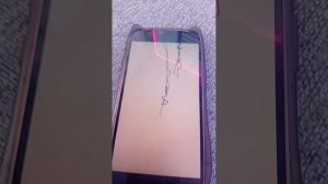 спрунки гипер снивтед фаза 11