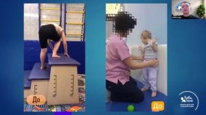 Моторный онтогенез: интеграция рефлексов в работе с ребенком раннего возраста