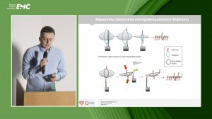 4 Канищев ИС, Шишин КВ Эндоскопические вмешательства при новообразованиях 12пк: 10-летний опыт МКНЦ