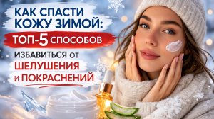Как спасти кожу зимой: ТОП‑5 способов избавиться от шелушения и покраснений