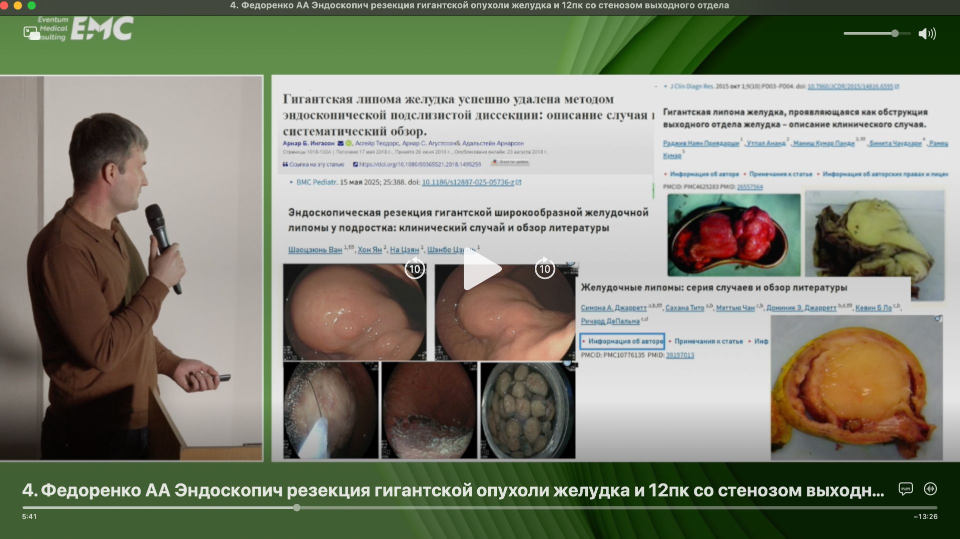 4. Федоренко АА, Павлов ПВ. Резекция гигантской опухоли желудка и 12пк со стенозом выходного отдела