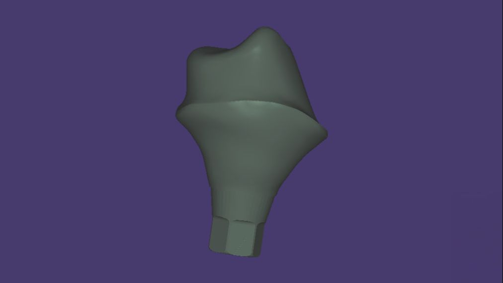 Премил Аббатмент в Exocad 3.3