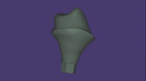 Премил Аббатмент в Exocad 3.3