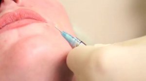 Процедура плазмолифтинга и плазмофиллинга. Плазмолифтинг в Москве. Лечение кожи головы в Москве.