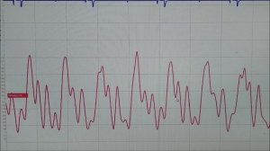 После ремонта   холодный двигатель  плохо  работает, диагностика осциллографом .