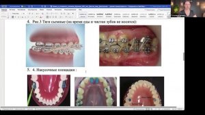 14.03.26 Не три кожу зря! Как правильно лепить лицо, чтобы не растянуть его еще сильнее