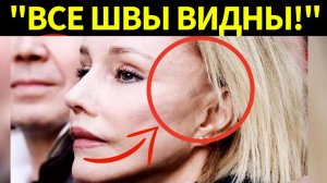 Жертва пластики! В сети активно обсуждают неудачную пластику Марины Зудиной вместо памяти Табакова