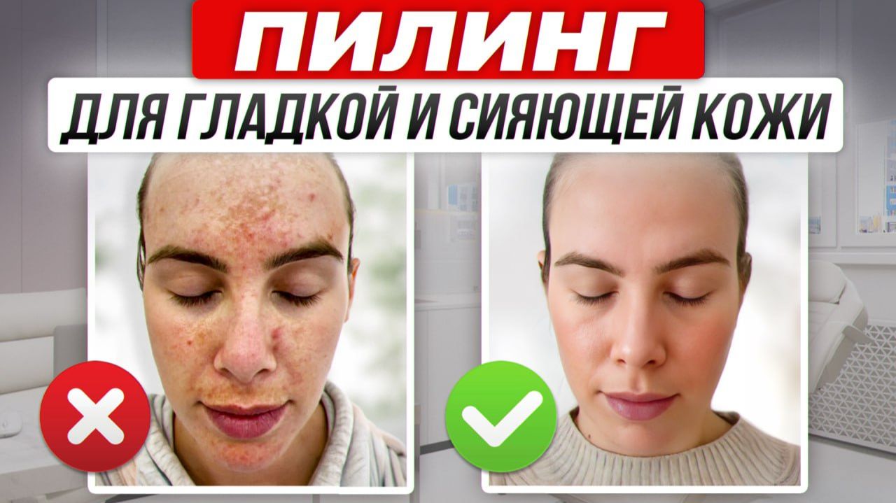 НАРОДНЫЕ СРЕДСТВА ДЛЯ КОЖИ. Разбираю каждое как технолог-химик